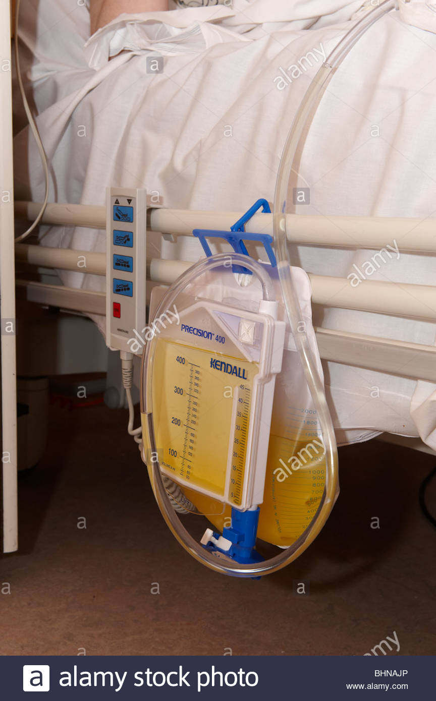 hospital-catheter-urine-bag-strapped-to-side-of-bed-BHNAJP.jpg