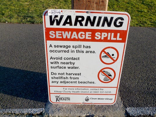 636214884262565949-Sewage-spill-sign.jpg